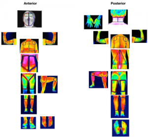 紅外熱像儀技術在周身部位的檢測